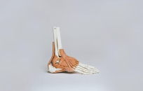 Osteoporosis/Osteopenia